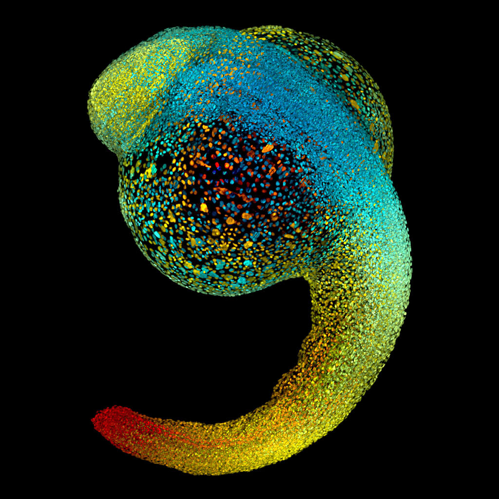 Fluoreszenzbild von Zebrafisch-Larven