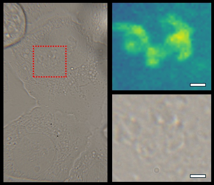 Live-cell-Messung mit subzellulärer Auflösung (U2OS-Zellen)