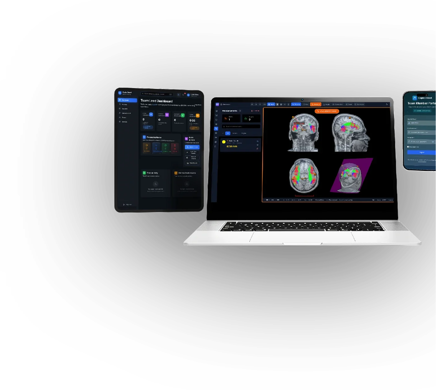 Capla Cortex Planung und Falldaten auf Desktop, Tablet und Mobilgerät