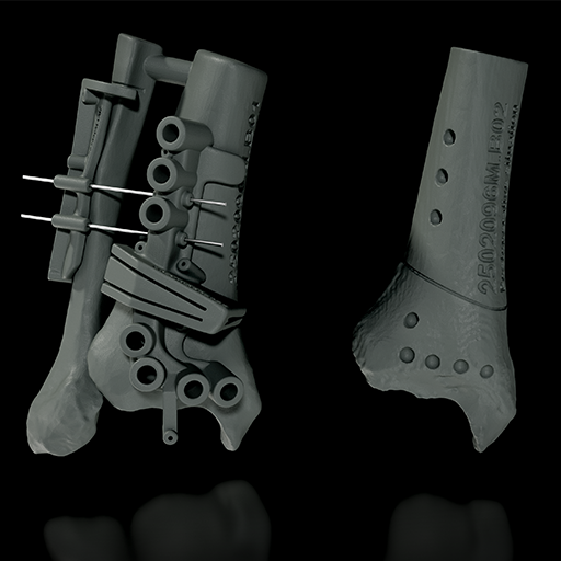 Guide and bone model