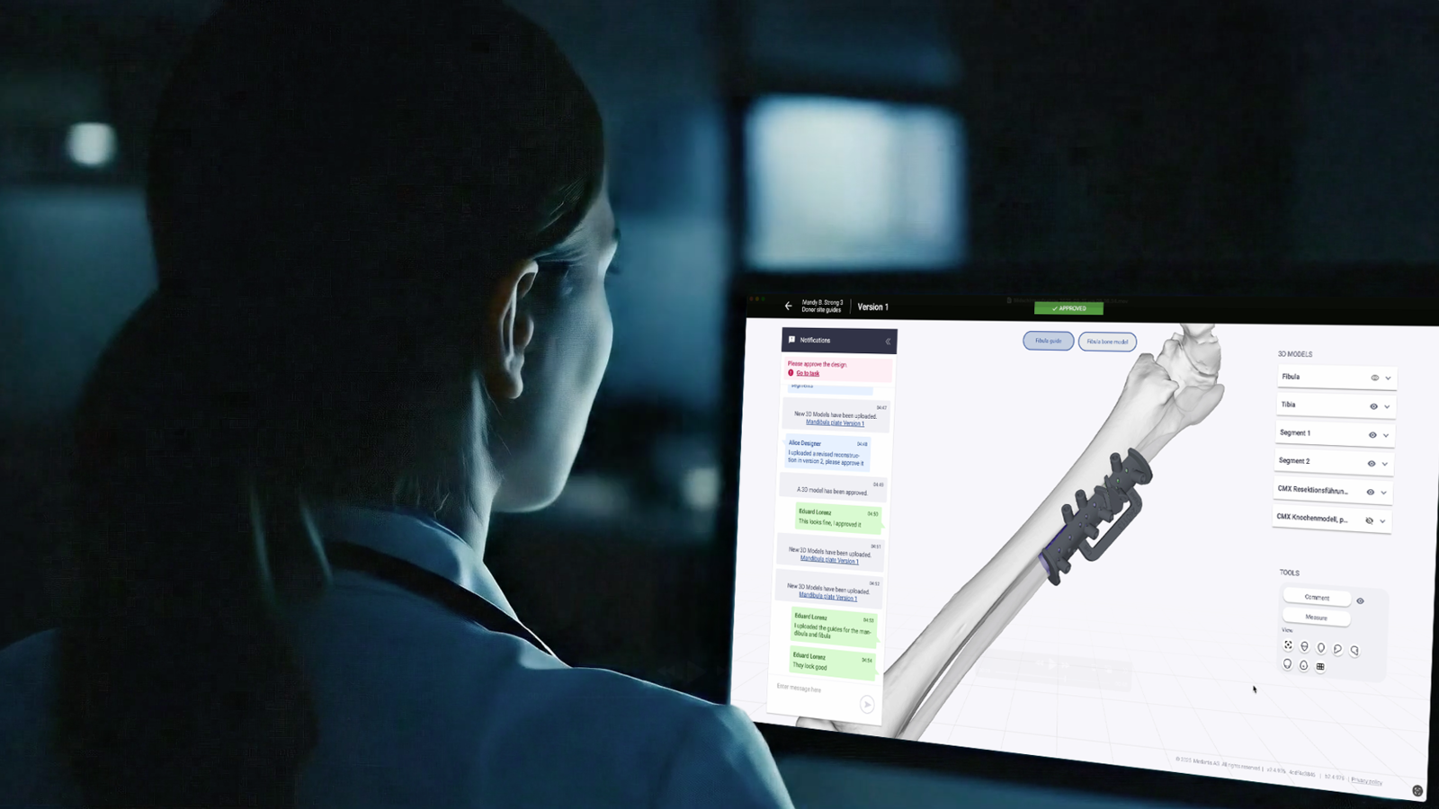 CMX Portal at the surgeon's PC