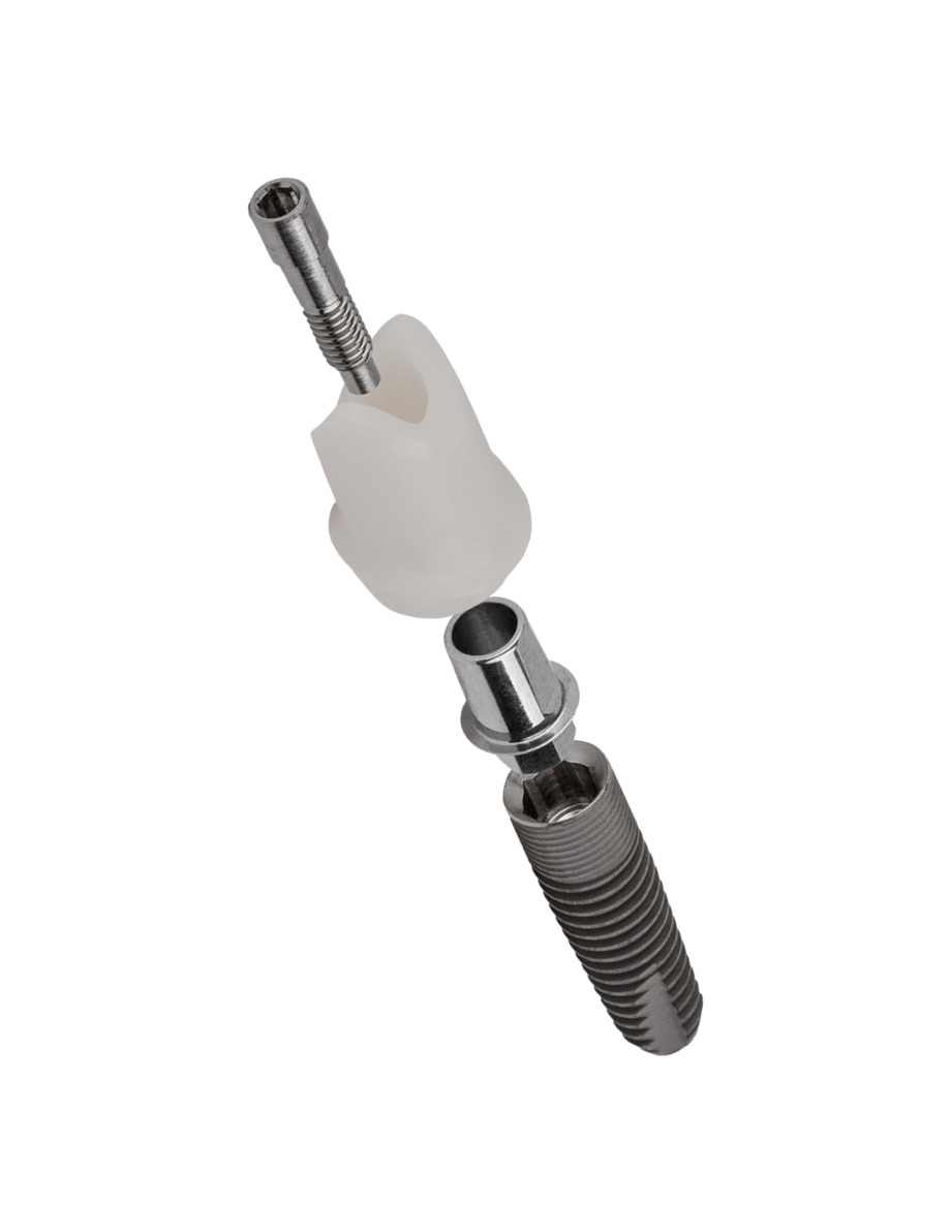 Zirkonabutment (CAD/CAM)