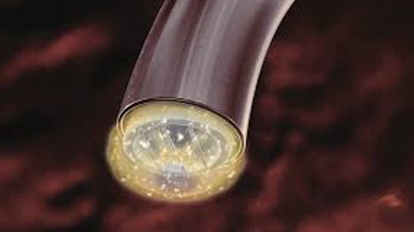 RF-Plasma Anwendung
