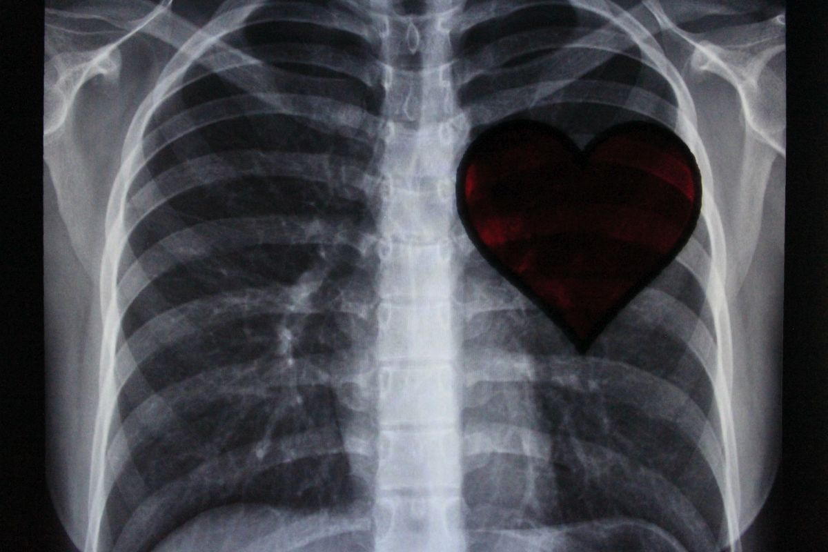 Kardiologische Diagnostik