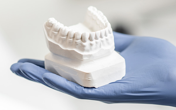 Dentalgipse Typ 2–4 (Giludur, Gilstone, Toprock)