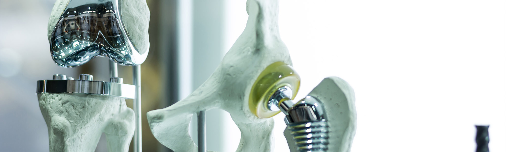 Implantate