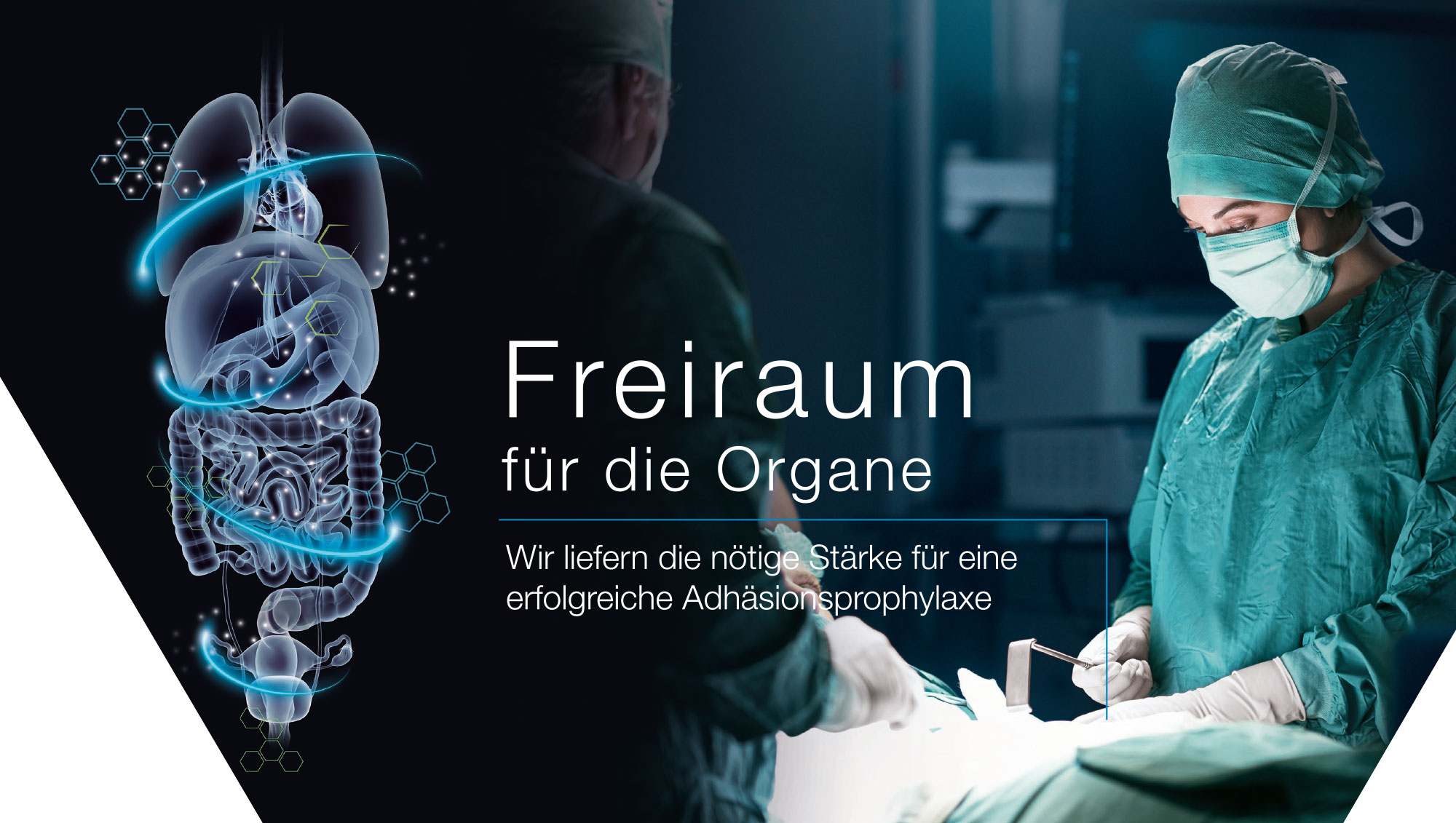 Adhesion prevention: Freedom for the organs