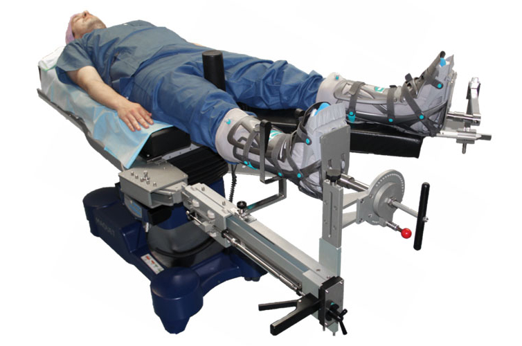 DASS extension table