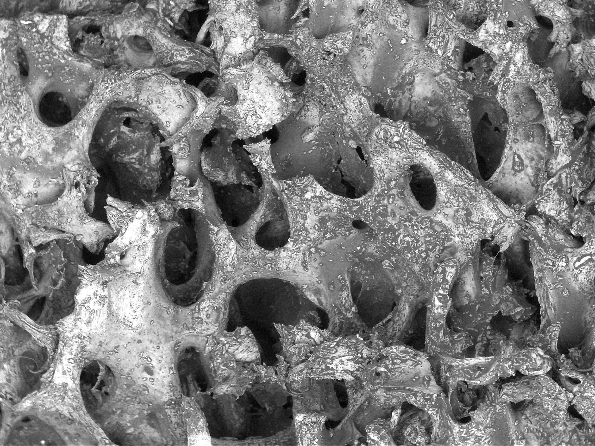 Scanning electron microscopy image