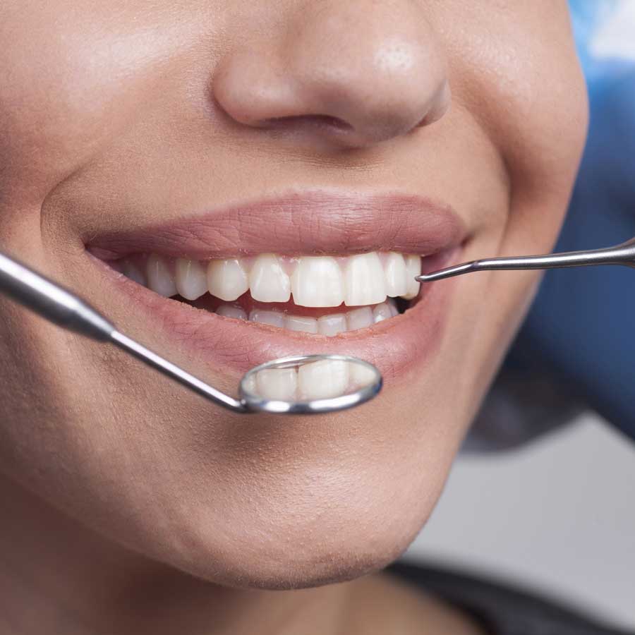 Prophylaxe und Bleaching