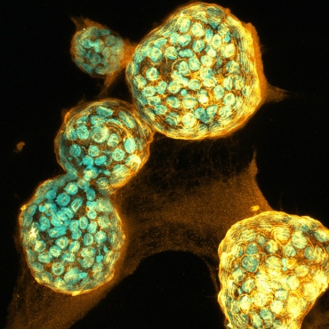 Laserbasierte Gewebeuntersuchung in der Biomedizintechnik