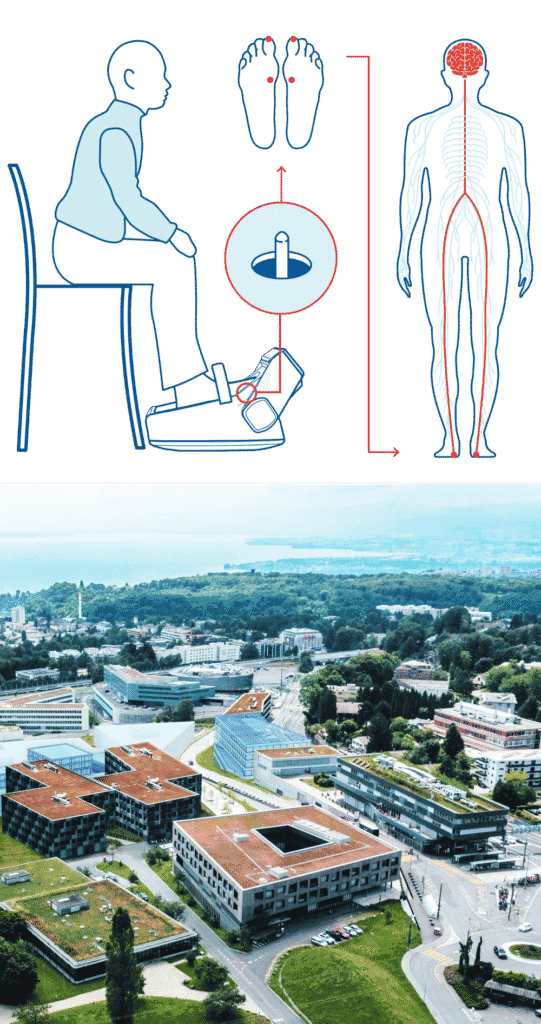 Anwendung des Gondola-Systems