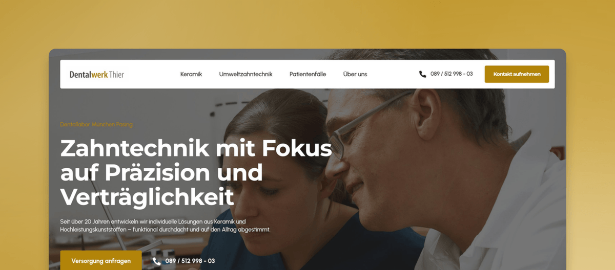 Vollkeramik-Krone, von Hand geschichtet