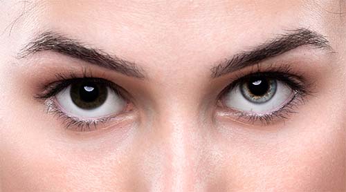 Artificial Iris CustomFlex
