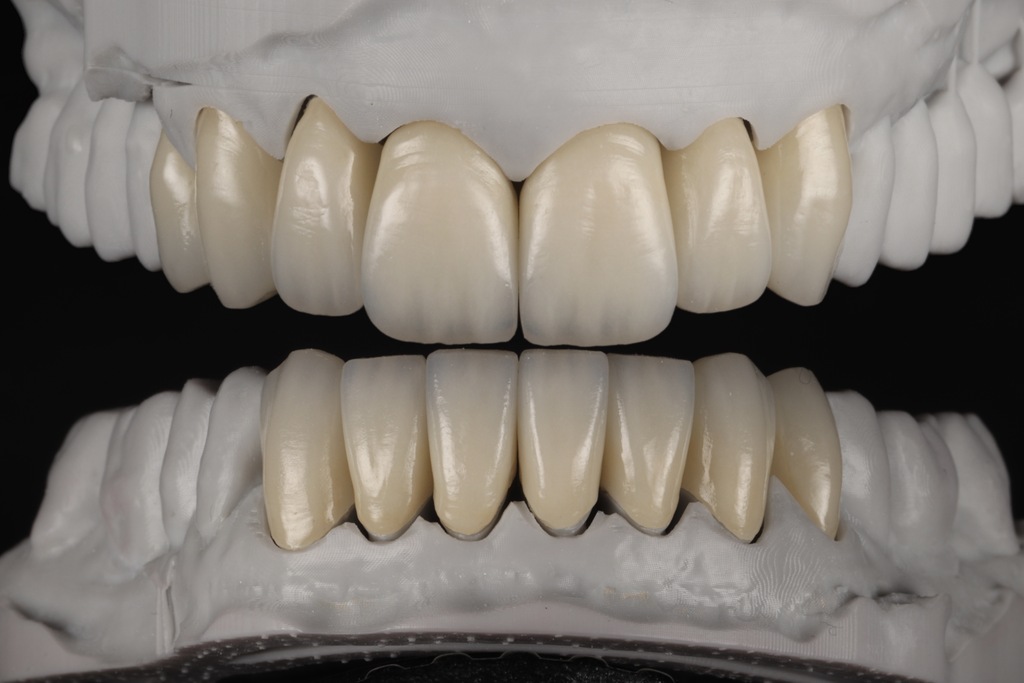 Fertigung im Dentallabor