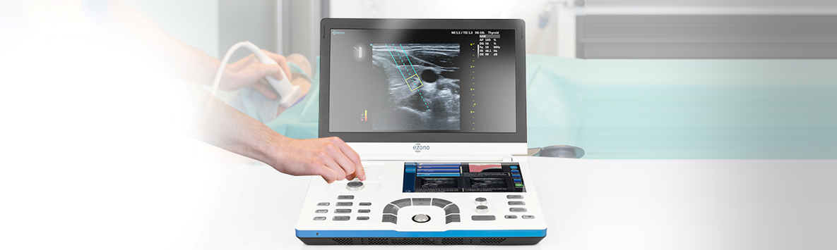 eZono 5000 – portables Ultraschallsystem