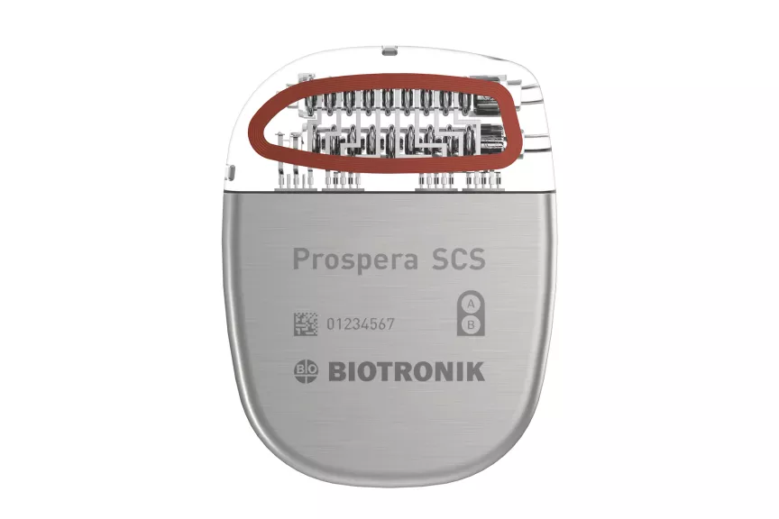 Prospera Spinal Cord Stimulation System