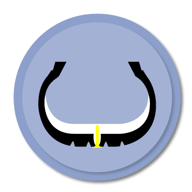 IMS – Reifenpannensystem