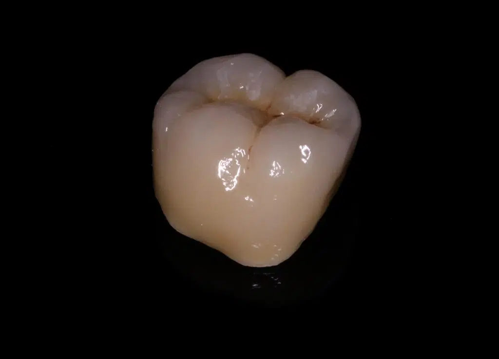Impressions from the Interdental dental laboratory