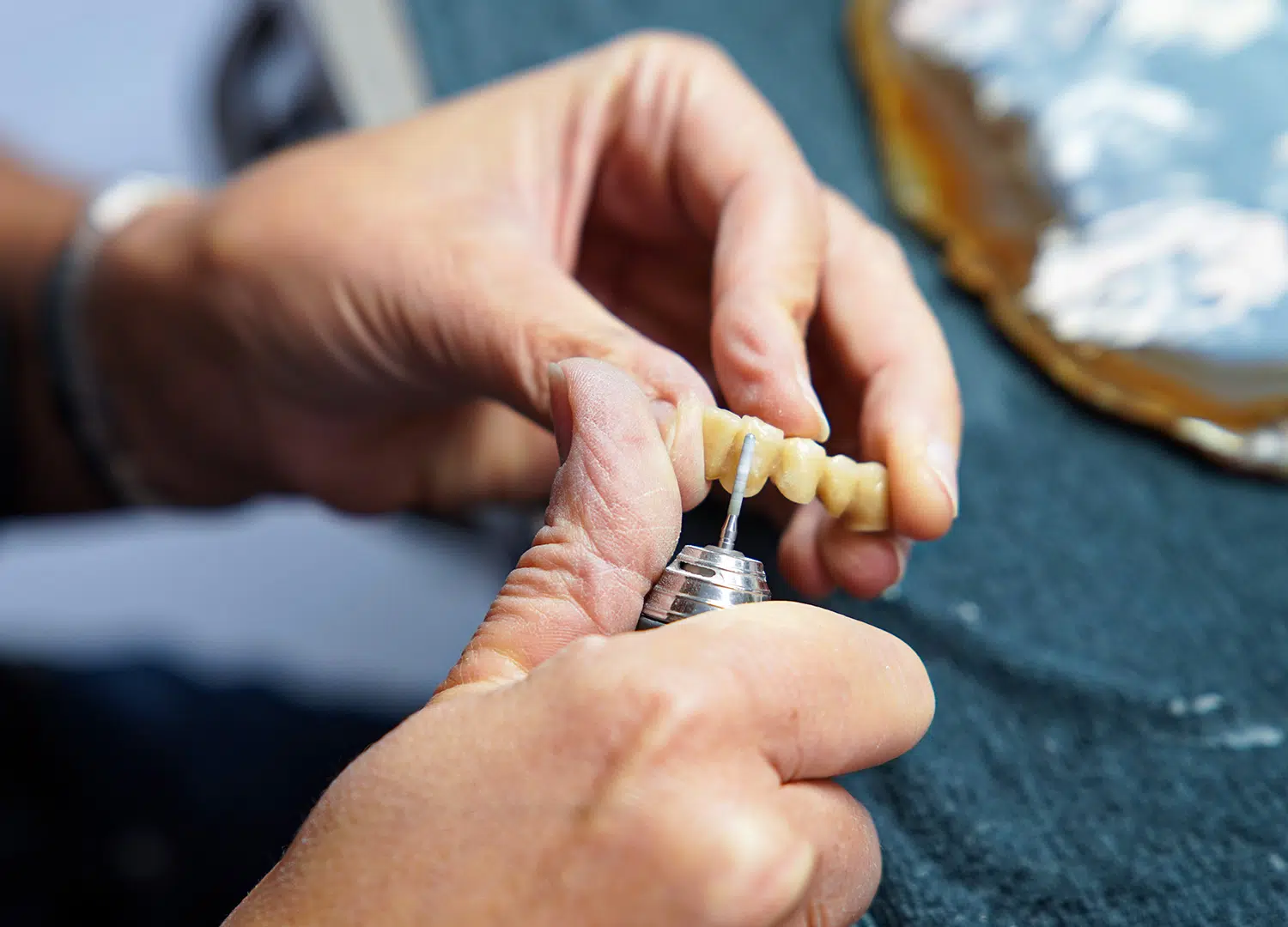 Custom dental prosthetics (crowns, bridges, telescopes)