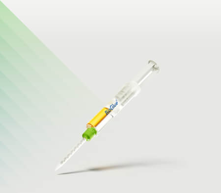 Chirurgischer Gewebekleber (BioGlue)