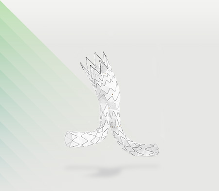 E-tegra Stent-Graft-System