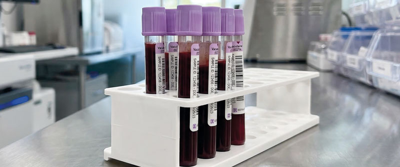MassTox® Drugs of Abuse Testing
