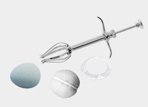 Orbitalimplantate