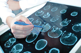 Diisopropylether als Extraktionsmittel