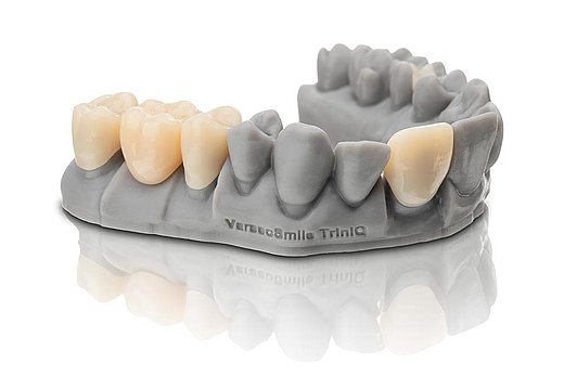 3D-gedruckte Restauration (VarseoSmile)