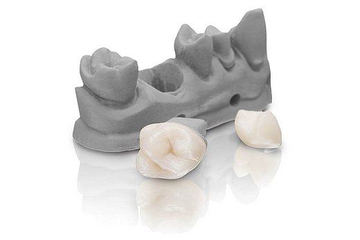 Vollkrone aus VarseoSmile Crown plus