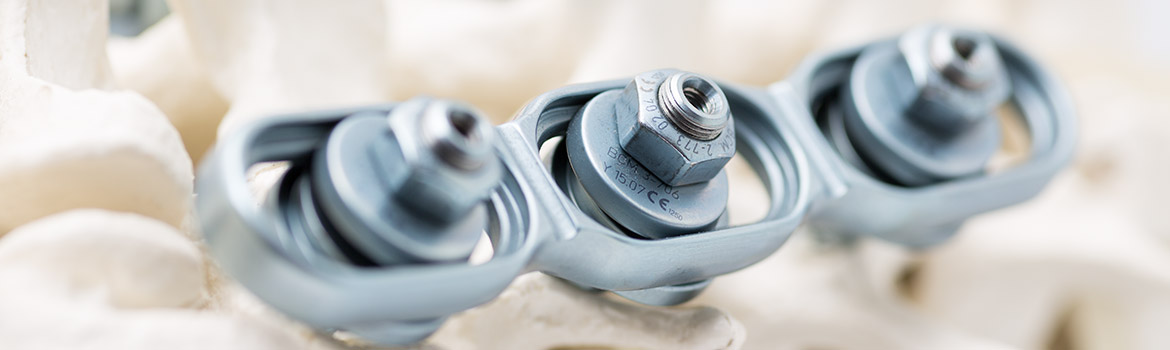 Knochenschrauben und Implantate
