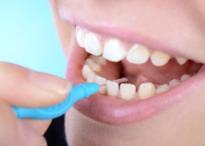 Interdentalbürsten für Zahnzwischenräume