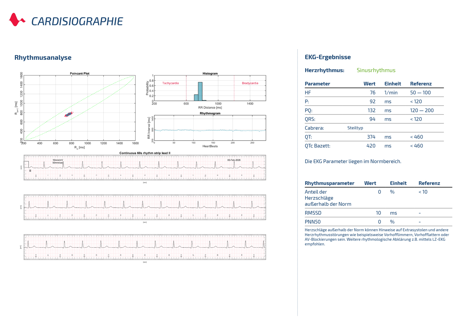 EKG und Rhythmusanalyse