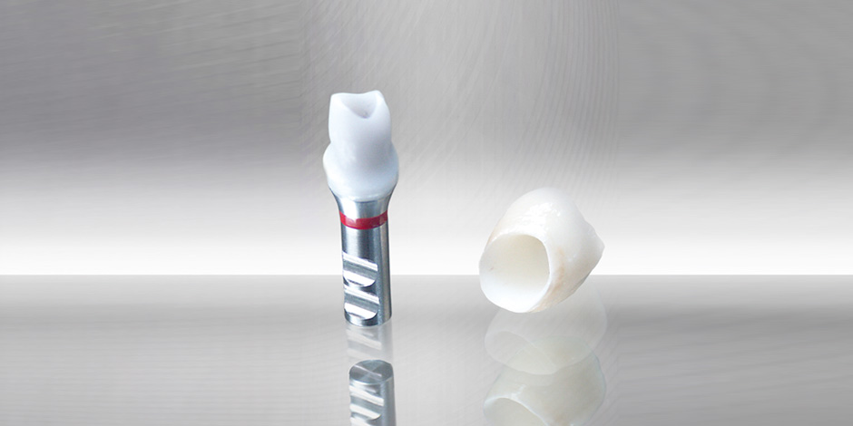 Zirkoniumdioxidabutment