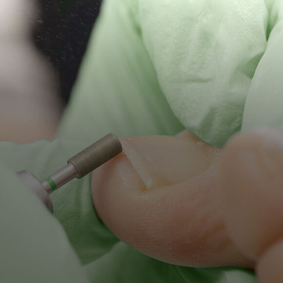 Podologie- und Nagelfräser