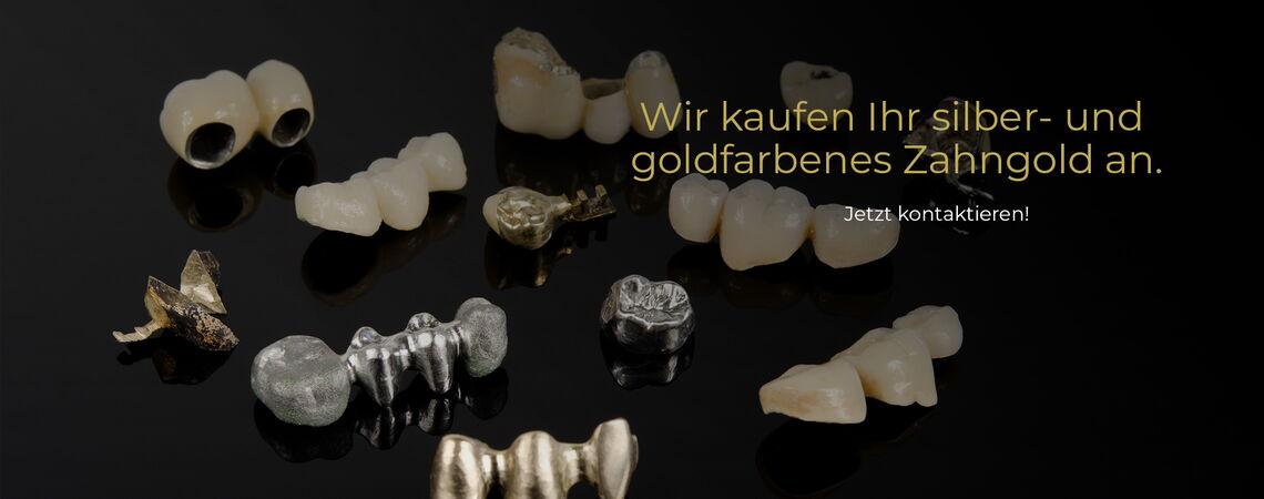 Zahngold