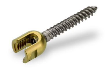Implant Orthopédique (orthopädisches Implantat)