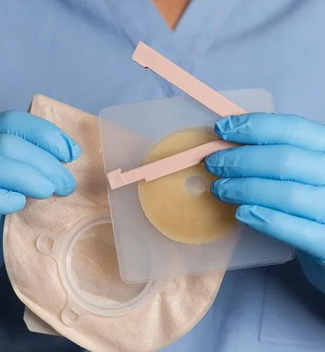 Stoma care