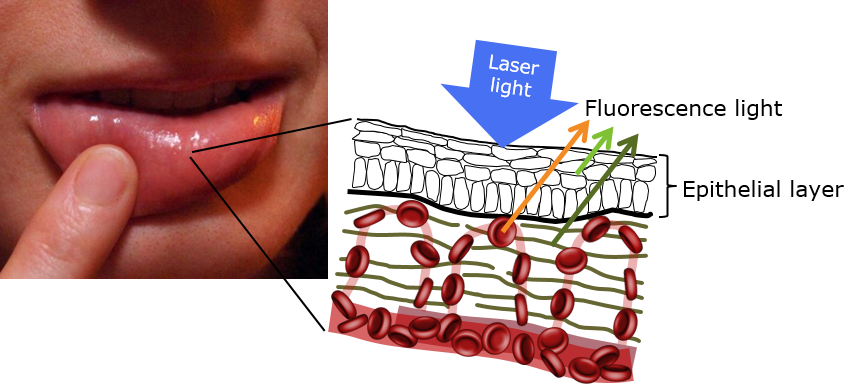 Messung Unterlippe im Fluoreszenzlicht