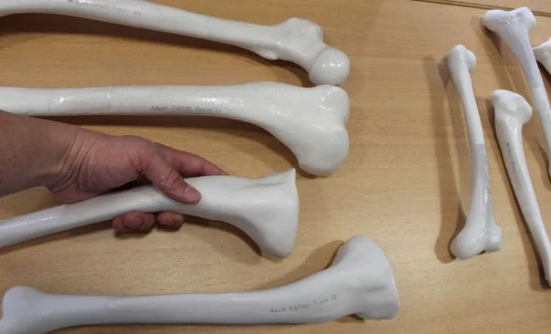 Boneplan® 1:1-Planungsmodell