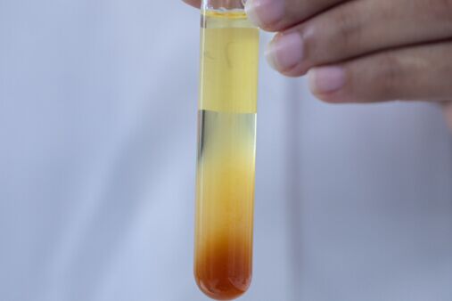 Emulsions-, Suspensions- und Schaumanalyse