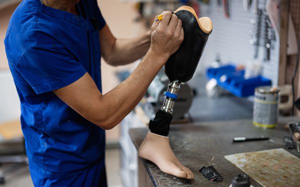 Orthopädietechnik-Mechaniker bei der Anpassung einer Prothese