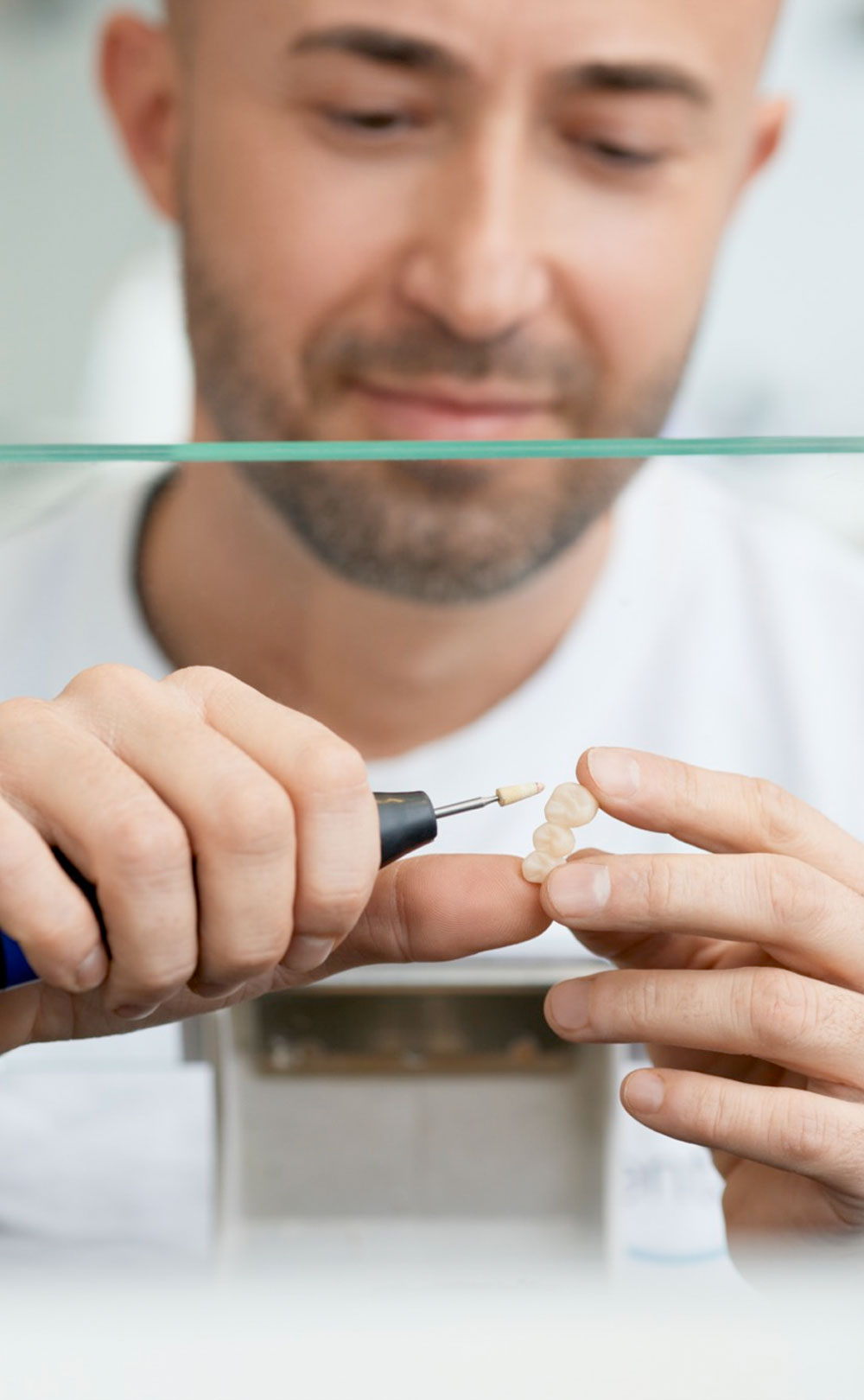 Implantatversorgung (Titan-Abutment)