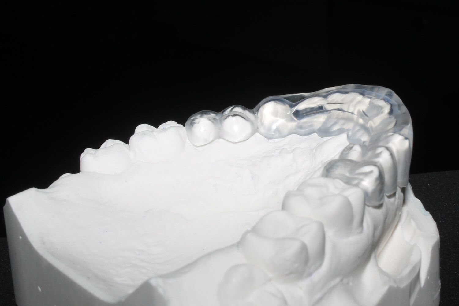 Clearsplint-Schiene