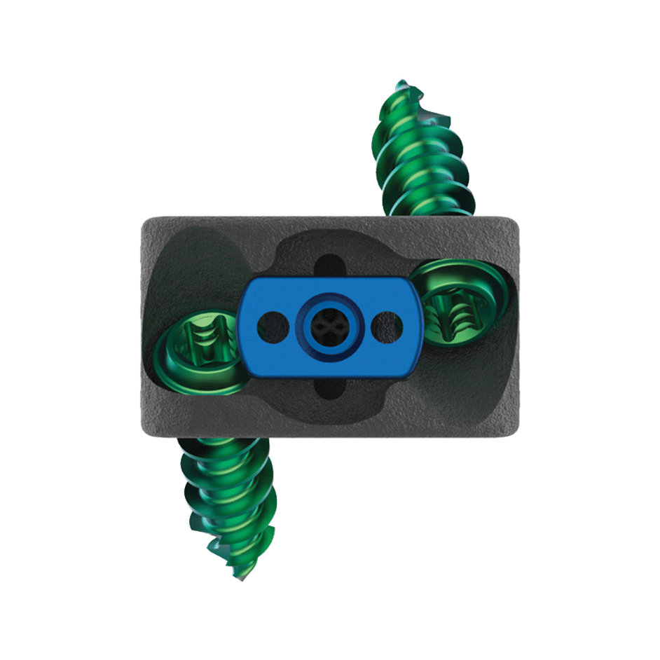 TrellOss-C SA Porous Ti Interbody System