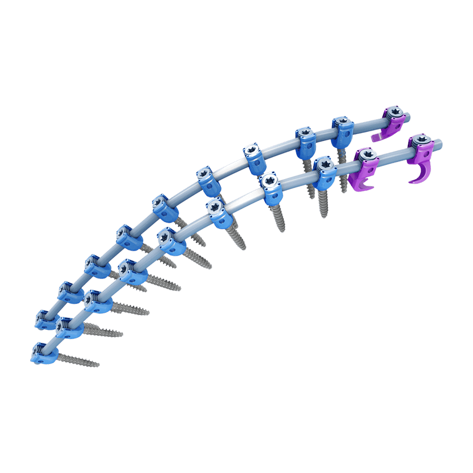 Vital Deformity Spinal Fixation System