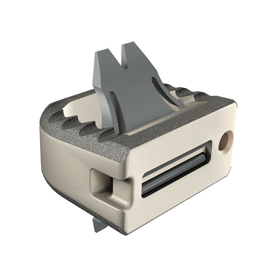 ROI-C Cervical Cage mit VerteBRIDGE Plating