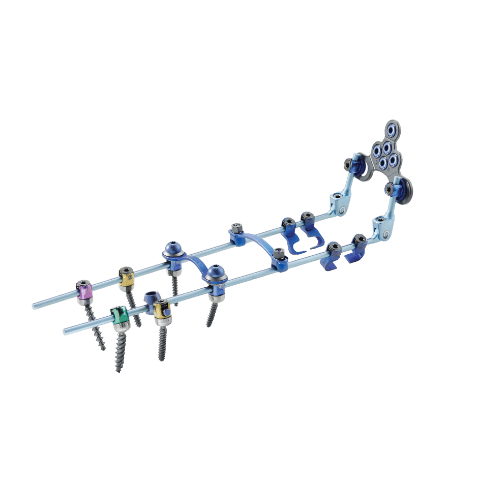 Virage OCT Spinal Fixation System