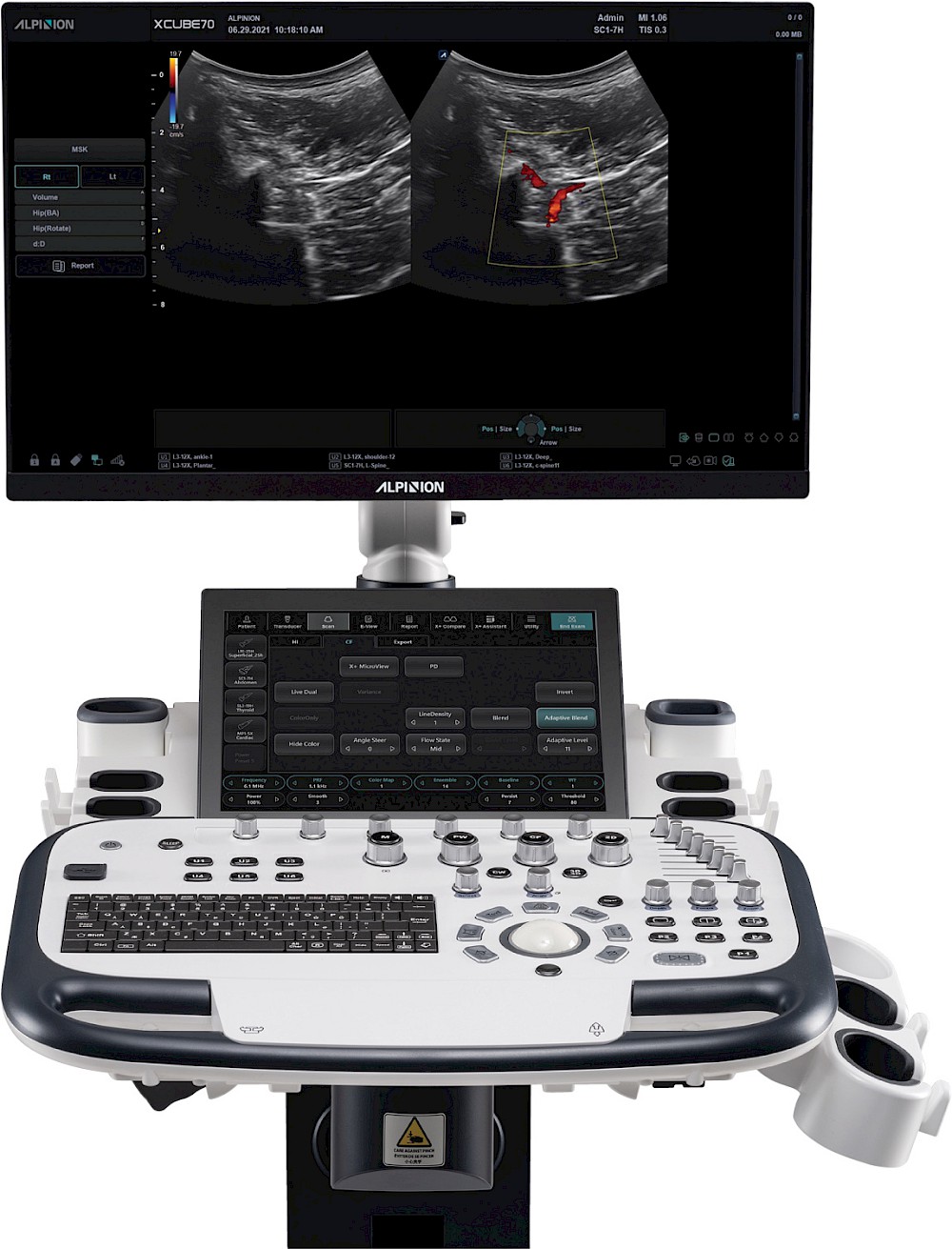 X-CUBE 70 with Elite – High-End Farbdoppler